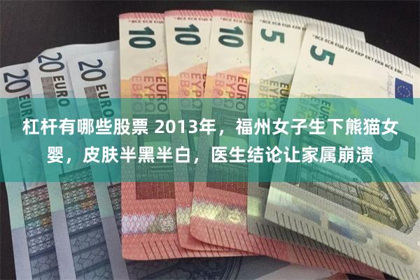 杠杆有哪些股票 2013年，福州女子生下熊猫女婴，皮肤半黑半白，医生结论让家属崩溃